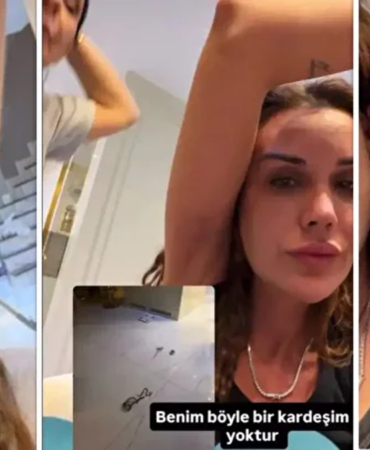 Polat Ailesinde Kardeş Kavgası Kanlı Bitti! Dilan Polat Yolunmuş Saçlarını Paylaştı: "Sıla Beni Darp Etti!"